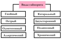 Разновидности гайморита