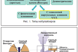 Виды небулайзеров