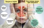 Какие могут быть причины запаха из носа?