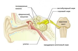 Неврит слухового нерва