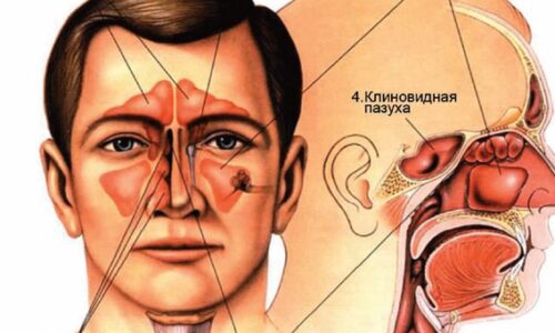 Что делать если не проходит заложенность носа?