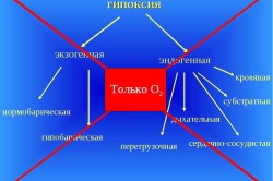 Гипоксия