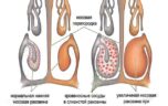 Какие капли в нос следует использовать при аллергическом рините?